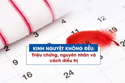 Kinh nguyệt không đều: Triệu chứng, nguyên nhân, điều trị